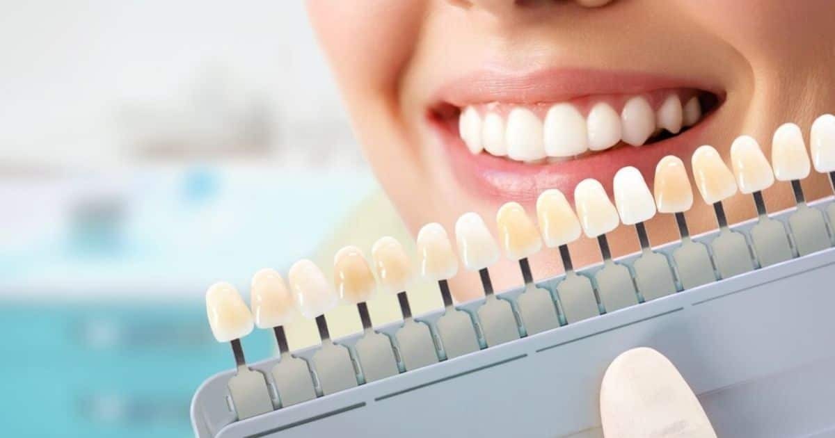 Woman comparing tooth shade samples to her natural smile for veneer color matching.