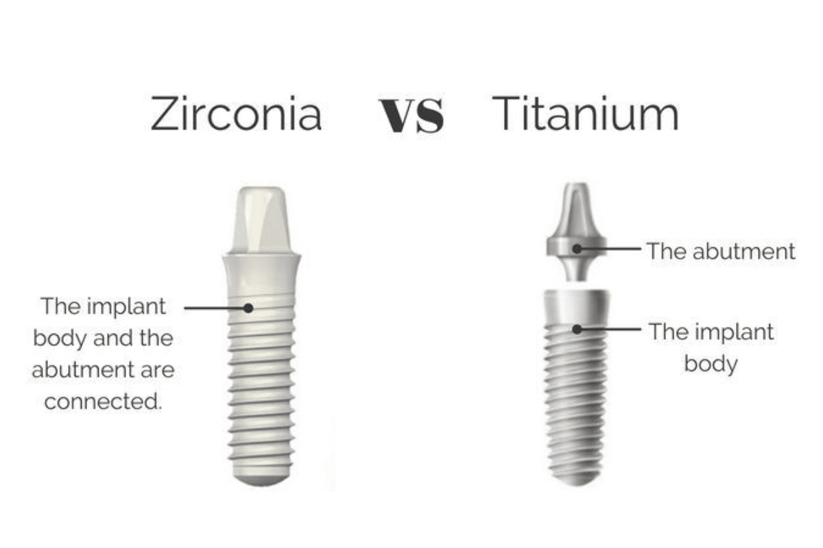 Zirconia vs titanium dental implant comparison showing integrated abutment design and separate components.