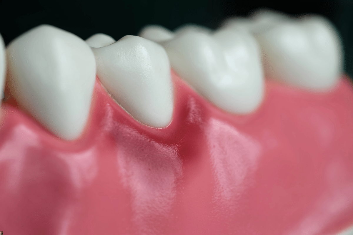 Healthy white teeth with pink gums showing proper gum health and dental care.