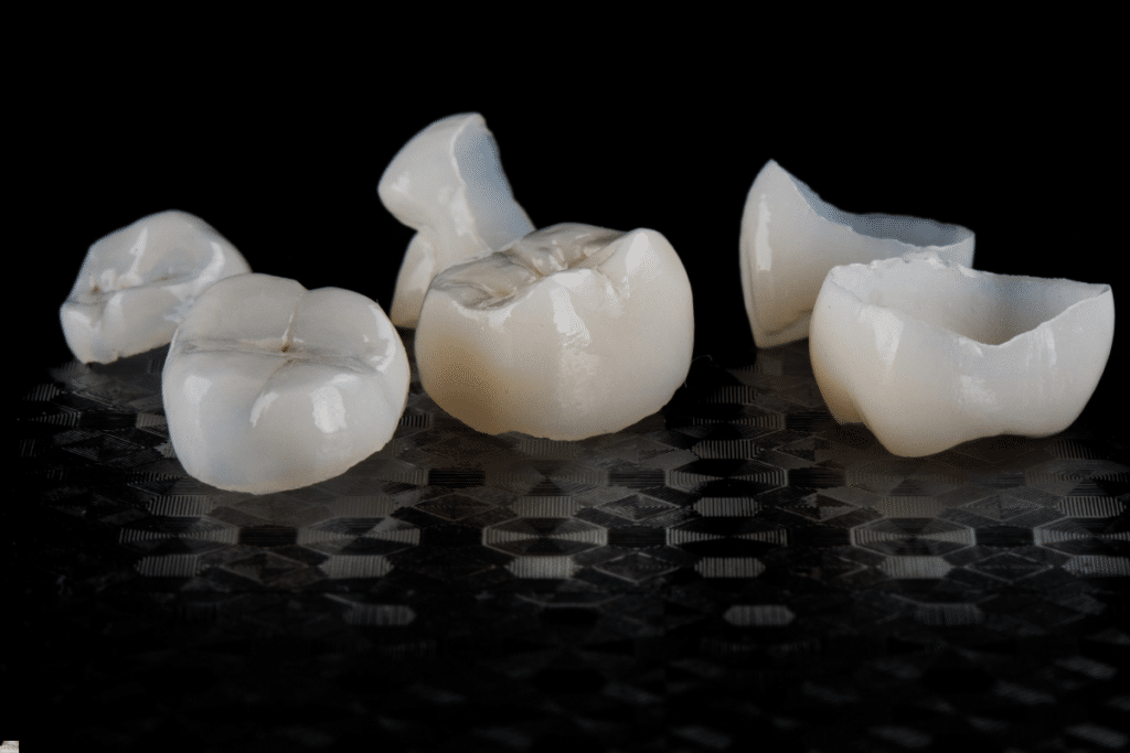 How Technology Is Revolutionizing Same-Day Dental Crowns