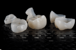 How Technology Is Revolutionizing Same-Day Dental Crowns