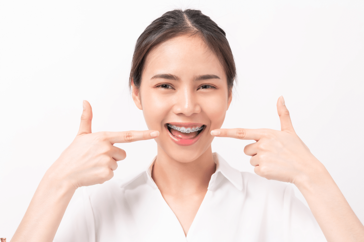 Young woman with dental braces smiling and pointing to her teeth, demonstrating proper orthodontic care results.