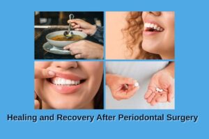 Post Gum Surgery Care for Long-Term Success
