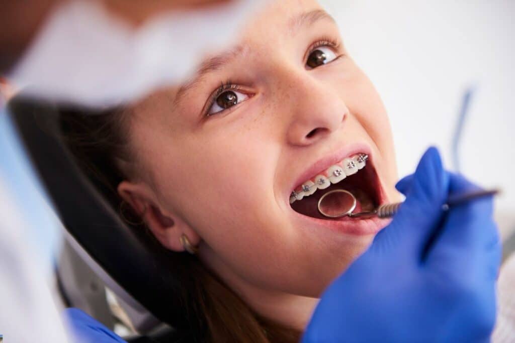 What is the Best Age for Kids to Get Braces?