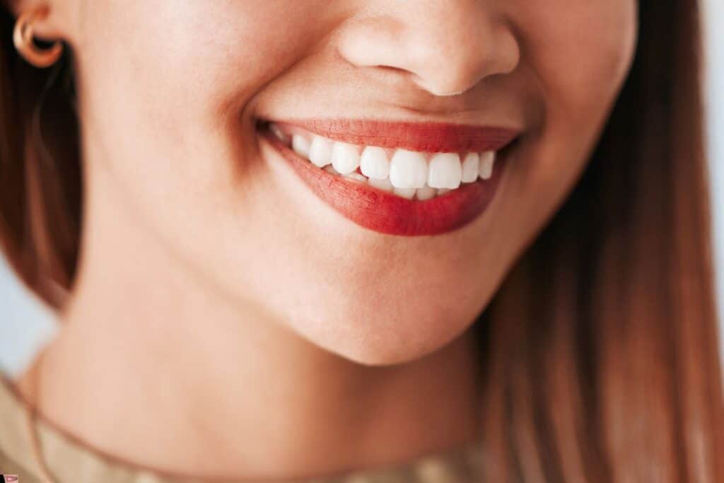 How to Clean Porcelain Veneers?