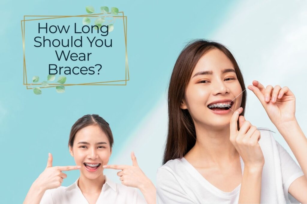 How Long Should You Wear Braces?