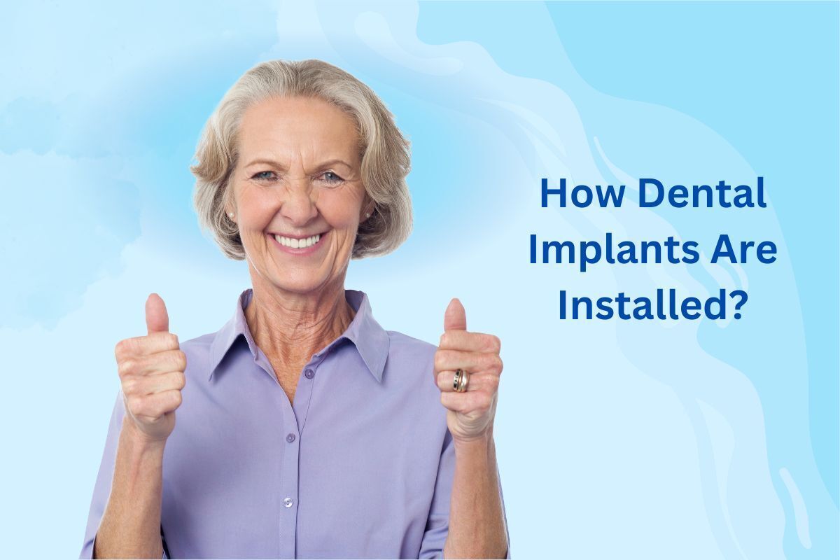 Senior woman giving thumbs up after successful dental implant installation in Brooklyn.
