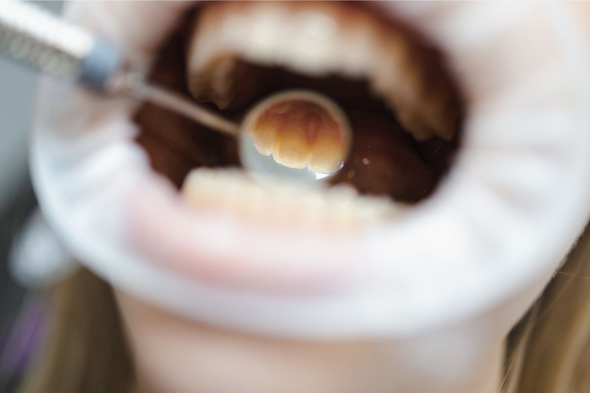 Dentist demonstrating intraoral camera technology for detailed tooth examination and digital treatment planning.