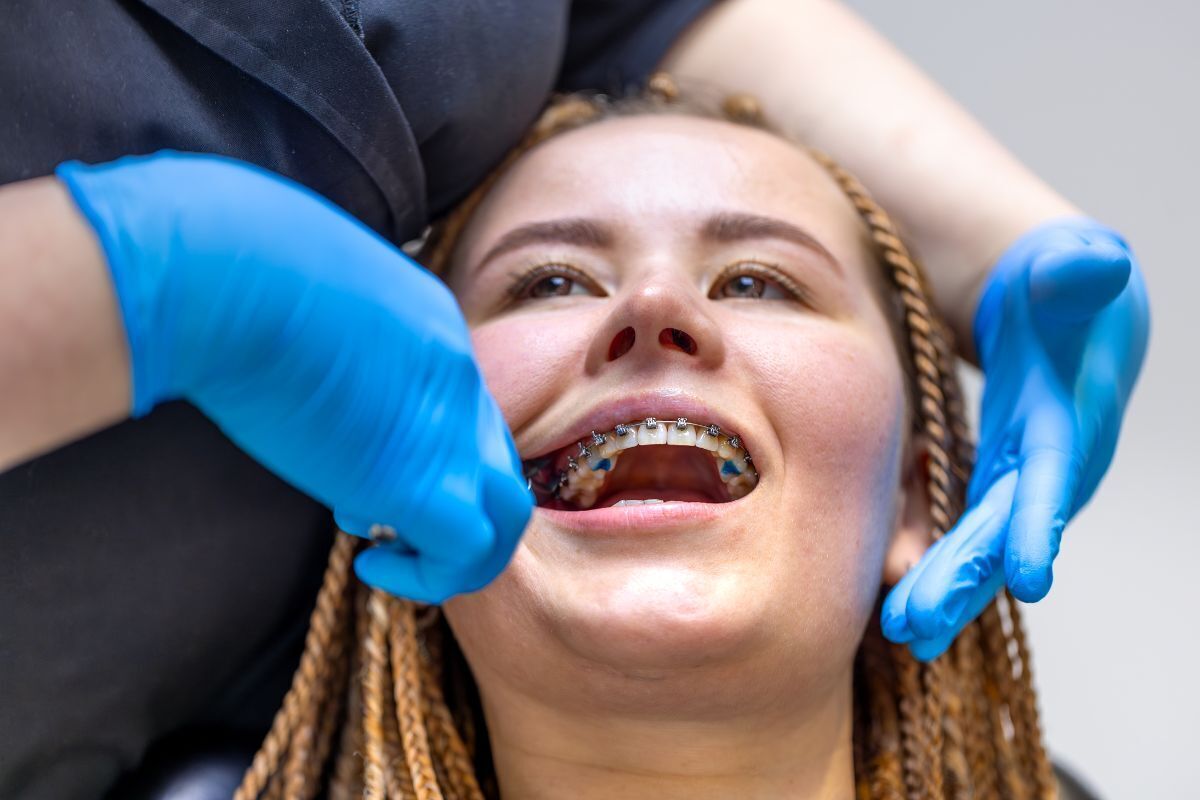 Orthodontist examining patient's teeth with braces during dental checkup in Brooklyn.