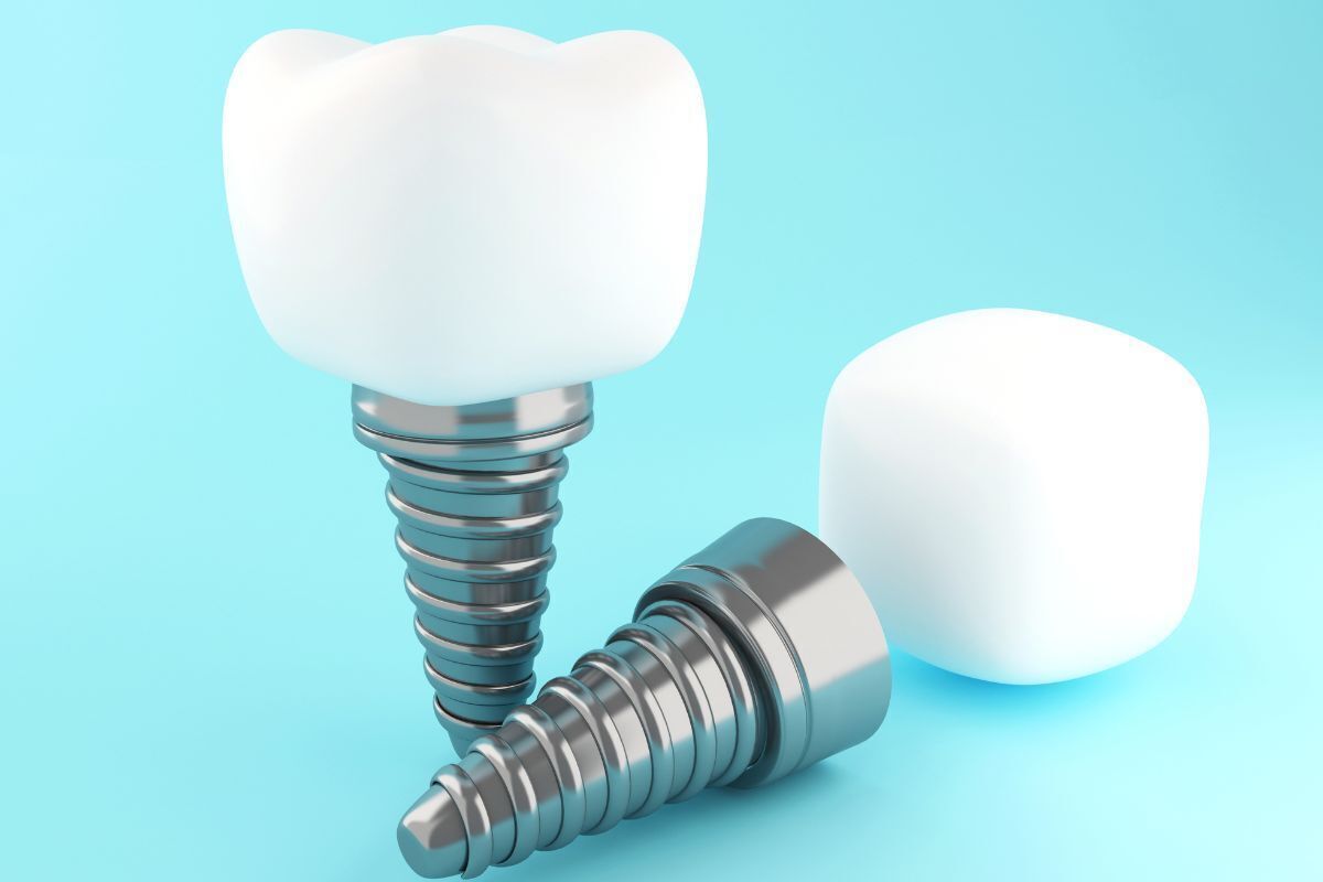 Dental implant components showing the titanium screw, abutment, and white crown on light blue background.