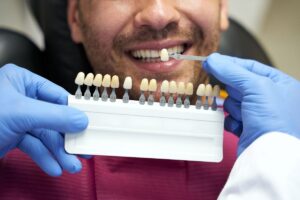 What to Do Before Teeth Whitening for Best Results?