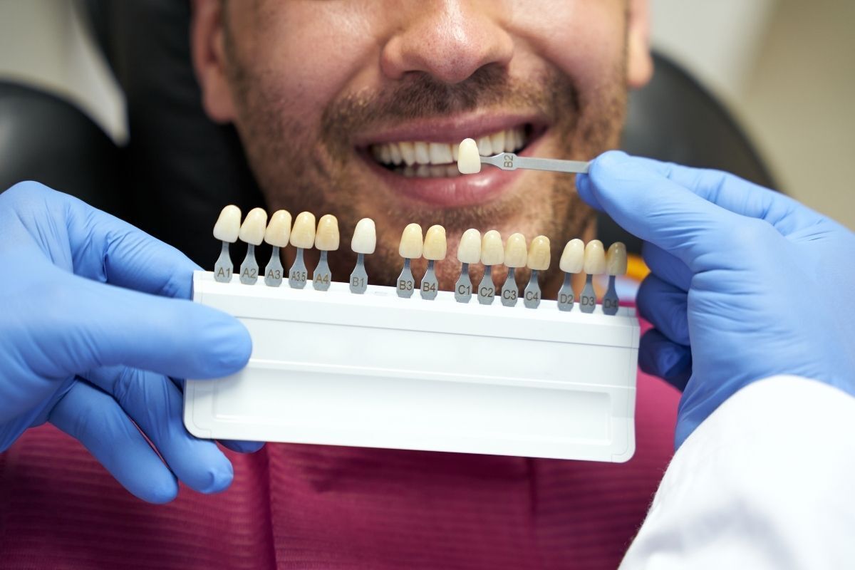 Dentist holding shade guide to match patient's tooth color for whitening treatment.