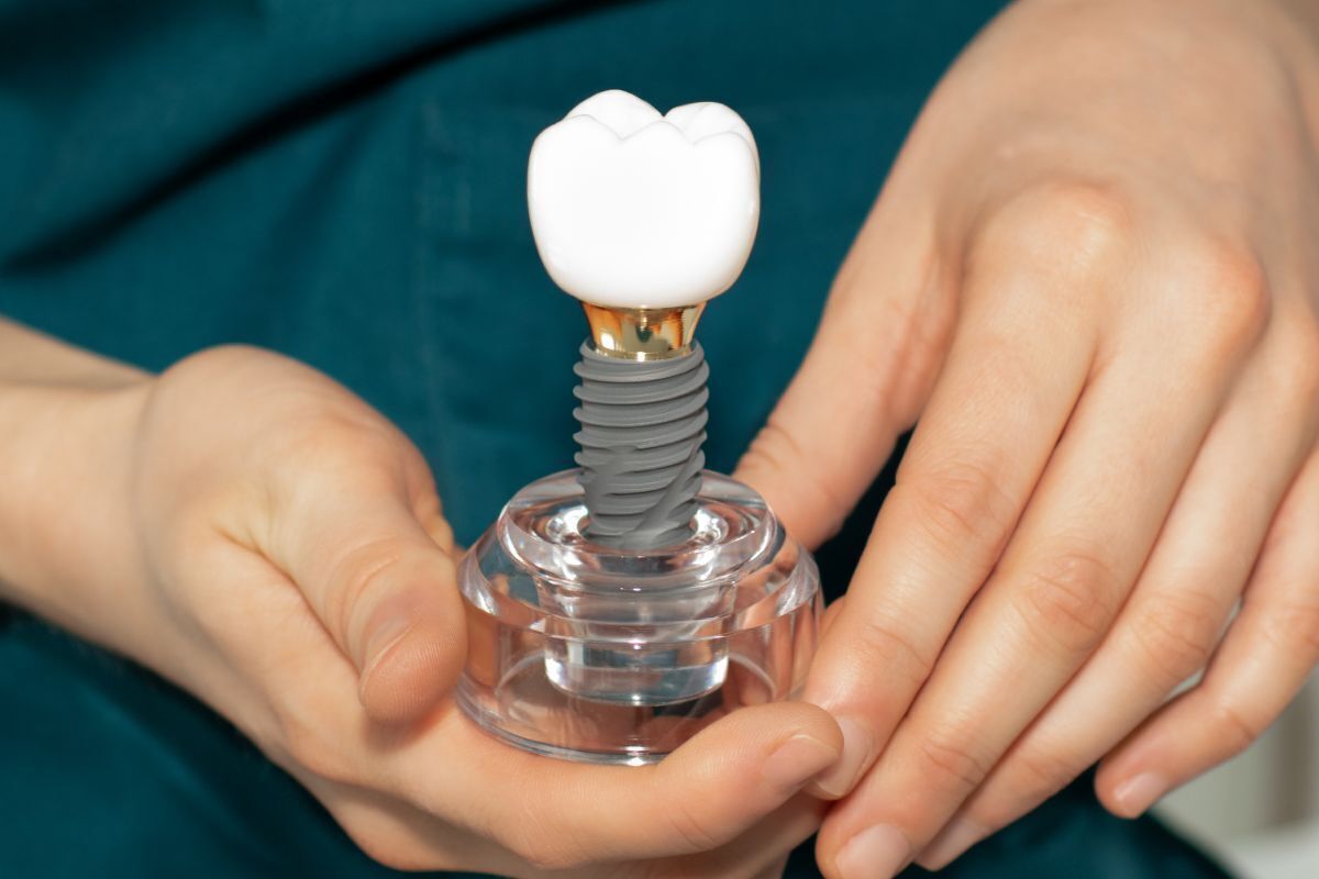 Dental implant model showing tooth crown and screw component held in hands.
