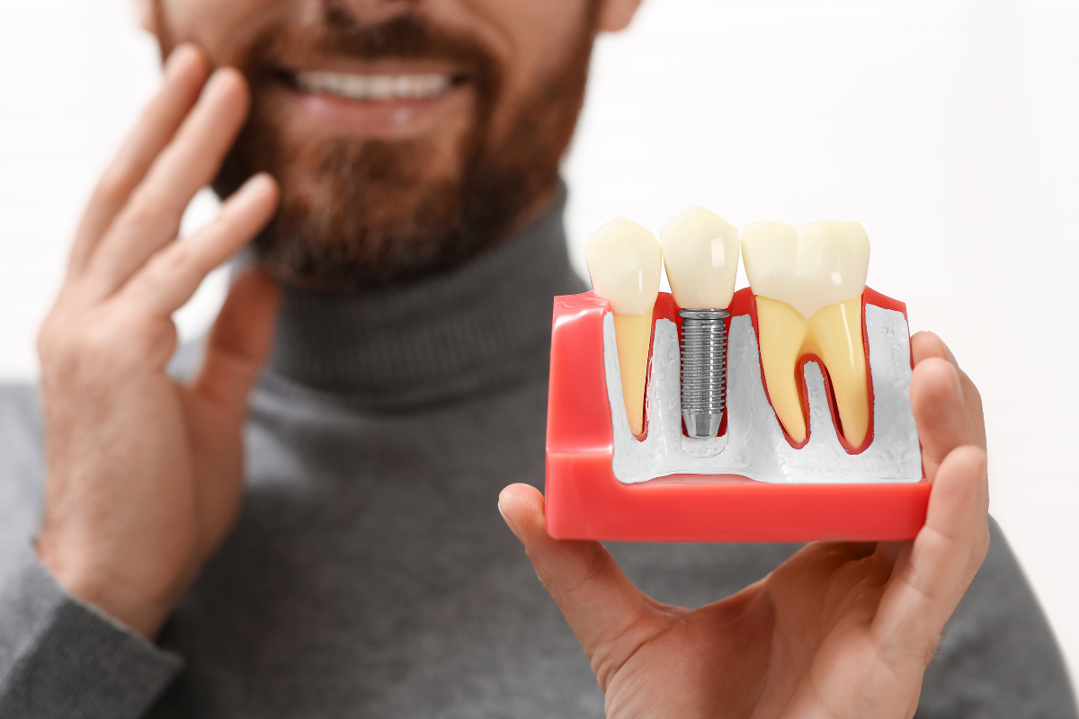Man holding dental implant model showing tooth replacement procedure with crown and screw.