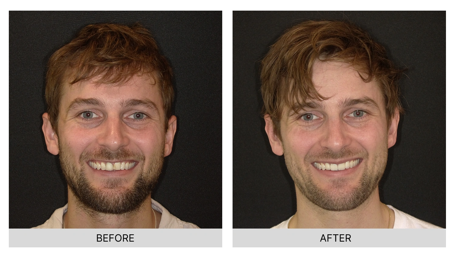 Transformation 1