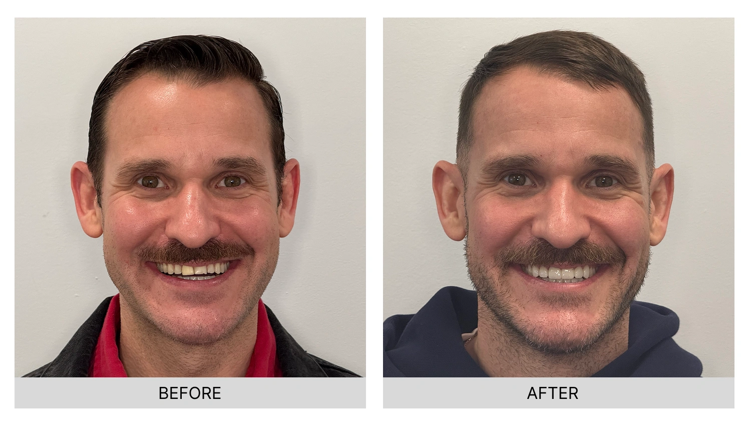 Transformation 3