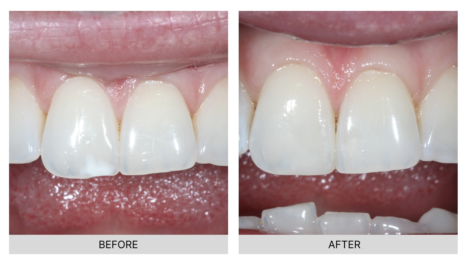 Transformation 4