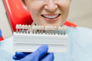 What Makes Veneers Look Natural? A Cosmetic Dentist Explains