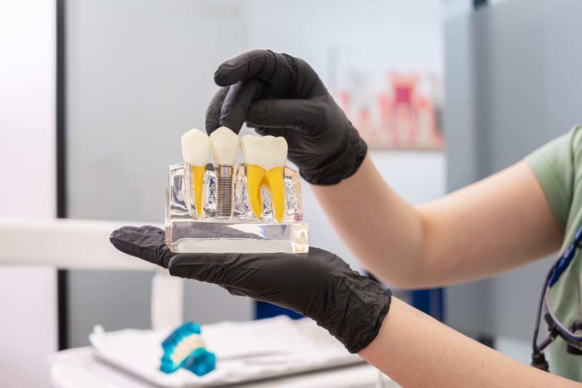 Dentist holding clear model showing dental implant components and natural tooth structure.