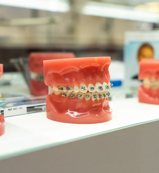 Clear dental aligners displayed in a case beside dental equipment